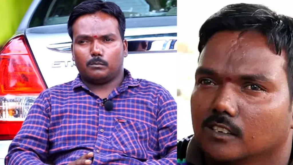 Social Media Sensation ‘Aggipette Maccha’ Dies After Severe Illness, Fans Left Heartbroken kiran